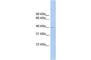 Human Lung; WB Suggested Anti-FCRLA Antibody Titration: 0. (FCRLA antibody  (C-Term, Isoform 9, Middle Region))