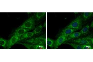 ICC/IF Image COX6A2 antibody [N3C3] detects COX6A2 protein at mitochondria by immunofluorescent analysis. (COX6A2 antibody  (C-Term))