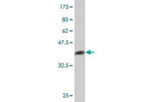 Western Blot detection against Immunogen (38. (CD103 antibody  (AA 57-171))