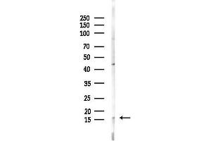 anti-Microsomal Glutathione S-Transferase 2 (MGST2) (Internal Region) antibody