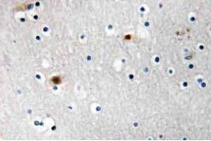 Immunohistochemistry (IHC) analyzes of TAF I p48 antibody in paraffin-embedded human brain carcinoma tissue. (SET/TAF-I antibody)