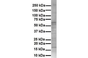 WB Suggested Anti-KRT16 antibody Titration: 1 ug/mL Sample Type: Human HepG2 (KRT16 antibody  (Middle Region))