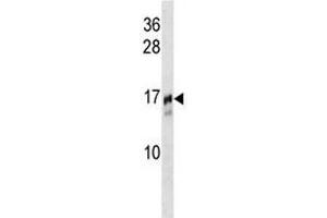 TRAPPC2 antibody western blot analysis in NCI-H292 lysate. (TRAPPC2 antibody  (AA 11-39))