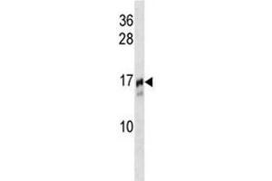 TRAPPC2 antibody western blot analysis in NCI-H292 lysate. (TRAPPC2 antibody  (AA 11-39))