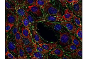 Western Blotting analysis (reducing conditions) of human Sos using anti-Sos (SOS-01). (Sos antibody)