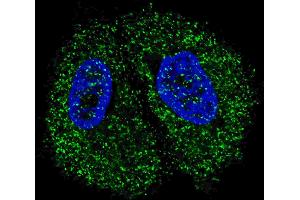 Fluorescent confocal image of MCF7 cells stained with Pyruvate Kinase (PKM2) antibody. (Pyruvate Kinase antibody  (C-Term))