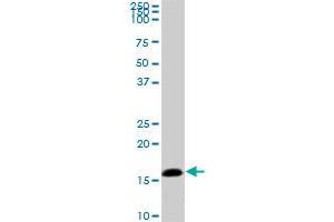 NME2 monoclonal antibody (M06), clone 1D3. (NME2 antibody  (AA 51-152))