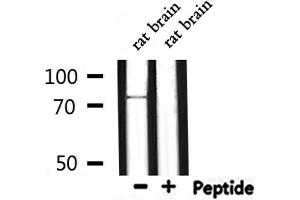 Western blot analysis of extracts from rat brain, using FOXP1 Antibody.