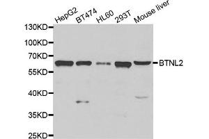 Western blot analysis of extracts of various cell lines, using BTNL2 antibody. (BTNL2 antibody)
