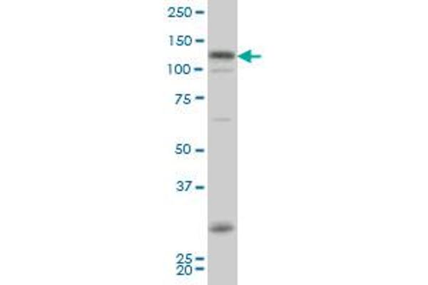 HIPK2 antibody  (AA 961-1065)