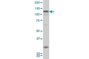 HIPK2 antibody  (AA 961-1065)