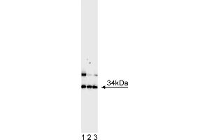 Western Blotting (WB) image for anti-Achaete-Scute Complex Homolog 1 (Drosophila) (ASCL1) antibody (ABIN967560) (ASCL1 antibody)