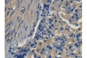 DAB staining on IHC-P; Samples: Mouse Stomach Tissue (TRAPPC10 antibody  (AA 1077-1259))