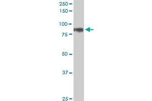 HIC1 monoclonal antibody (M01), clone 4E11. (HIC1 antibody  (AA 396-453))