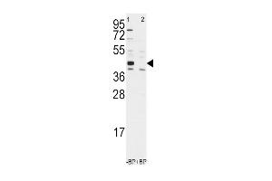 ALDH1A3 antibody  (AA 318-348)