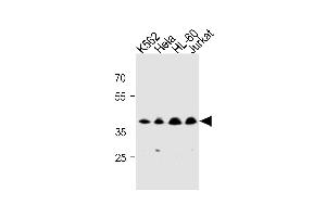 MECR Antibody (Center) (ABIN1881536 and ABIN2843275) western blot analysis in K562,Hela,HL-60,Jurkat cell line lysates (35 μg/lane).