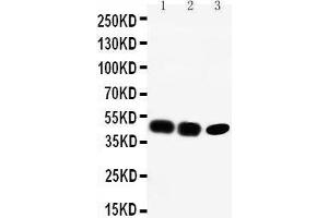 Anti-CCR6 antibody, Western blotting Lane 1: Rat Liver Tissue Lysate Lane 2: SW620 Cell Lysate Lane 3: CEM Cell Lysate (CCR6 antibody  (C-Term))