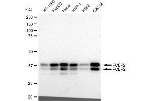 Western blotting analysis using PCBP2 antibody (ABIN7799871). (Recombinant PCBP2 antibody)