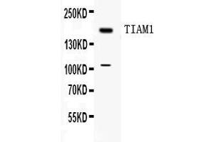 Western blot analysis of TIAM1 expression in MCF-7 whole cell lysates ( Lane 1). (TIAM1 antibody  (C-Term))