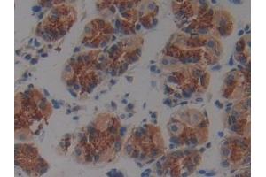 DAB staining on IHC-P; Samples: Human Stomach Tissue (Plakophilin 2 antibody  (AA 571-849))