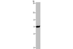 Western Blotting (WB) image for anti-Zinc Finger CCCH-Type Containing 12A (ZC3H12A) antibody (ABIN2828862) (ZC3H12A antibody)