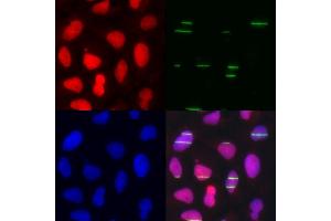 Immunofluorescence analysis of U2OS cells using POLE3 antibody (ABIN5973867). (POLE3 antibody)