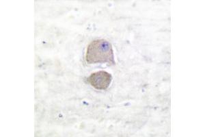 Image no. 1 for anti-BCL2-Associated X Protein (BAX) antibody (ABIN265325) (BAX antibody)