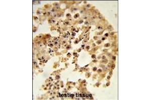 Formalin-fixed and paraffin-embedded human testis tissue reacted with D Antibody (N-term), which was peroxidase-conjugated to the secondary antibody, followed by DAB staining. (DPP8 antibody  (N-Term))