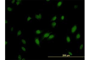 Immunofluorescence of monoclonal antibody to RNMT on HeLa cell. (RNMT antibody  (AA 1-476))