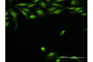 Immunofluorescence of purified MaxPab antibody to TRADD on HeLa cell. (TRADD antibody  (AA 1-312))