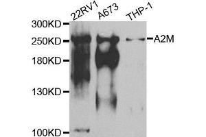 Western blot analysis of extracts of various cell lines, using A2M antibody. (alpha 2 Macroglobulin antibody  (AA 1155-1474))
