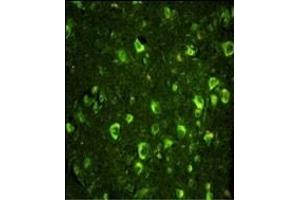 Immunofluorescence analysis of ABI1 Antibody (N-term) with paraffin-embedded human brain tissue. (ABI1 antibody  (N-Term))