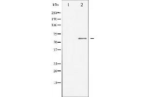 Western blot analysis of Dab1 expression in HepG2 whole cell lysates,The lane on the left is treated with the antigen-specific peptide. (DAB1 antibody  (Internal Region))