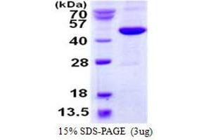 Methionyl Aminopeptidase 1 (METAP1) protein (His tag)