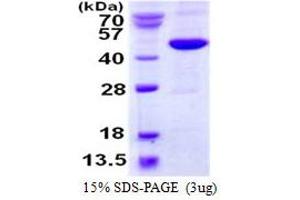 Image no. 1 for Methionyl Aminopeptidase 1 (METAP1) protein (His tag) (ABIN1098259)