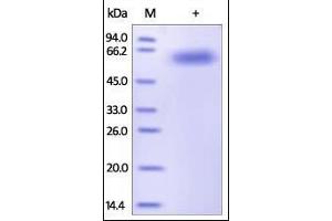 SDS-PAGE (SDS) image for Interleukin 2 Receptor, beta (IL2RB) (AA 27-239) (Active) protein (Fc Tag) (ABIN2181388) (IL2 Receptor beta Protein (AA 27-239) (Fc Tag))