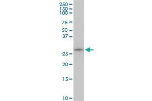 MAGEA12 monoclonal antibody (M01), clone 3A10. (MAGEA12 antibody  (AA 70-168))