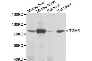 Western blot analysis of extracts of various cell lines, using TGM5 antibody. (Transglutaminase 5 antibody)