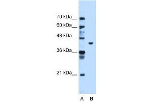 PGK1 antibody used at 1. (PGK1 antibody  (C-Term))
