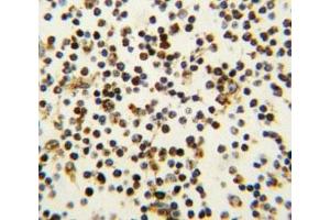Immunohistochemistry (IHC) image for anti-Nucleophosmin (Nucleolar phosphoprotein B23, Numatrin) (NPM1) (AA 7-33) antibody (ABIN3032075)