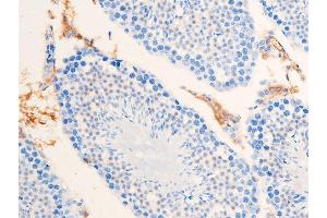 ABIN6267223 at 1/100 staining mouse testicular tissue sections by IHC-P.