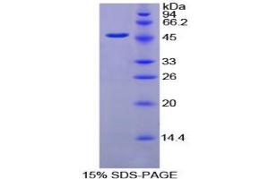 SDS-PAGE analysis of Chicken Fibrinogen gamma Protein. (FGG Protein)