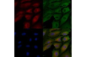 ABIN7094440 and ABIN7098488 staining  cells by IF/ICC. (Tenascin N antibody  (C-Term))