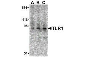 Western Blotting (WB) image for anti-Toll-Like Receptor 1 (TLR1) (N-Term) antibody (ABIN2479707) (TLR1 antibody  (N-Term))