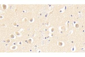 Detection of SKP1 in Human Cerebrum Tissue using Polyclonal Antibody to S-Phase Kinase Associated Protein 1 (SKP1) (SKP1 antibody  (AA 1-163))