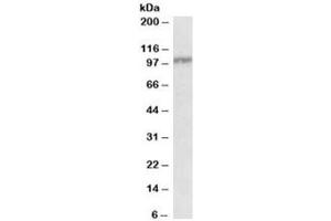 Western blot testing of peripheral blood lymphocyte lysate with IL12RB1 antibody at 0. (IL12RB1 antibody)
