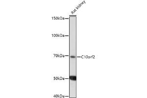 Western blot analysis of extracts of Rat kidney, using C10orf2 antibody (ABIN6129358, ABIN6137715, ABIN6137717 and ABIN6220923) at 1:1000 dilution. (C10orf2 antibody  (AA 385-684))