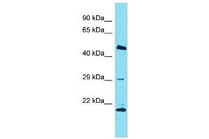 Host:  Rabbit  Target Name:  Relb  Sample Type:  Rat Thymus lysates  Antibody Dilution:  1. (RELB antibody  (C-Term))