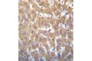 Immunohistochemistry analysis in formalin fixed and paraffin embedded human liver tissue reacted with JARID1A Antibody (C-term) followed which was peroxidase conjugated to the secondary antibody and followed by DAB staining.