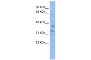 Image no. 1 for anti-Kelch Repeat and BTB (POZ) Domain Containing 5 (KBTBD5) (AA 251-300) antibody (ABIN6742509) (KBTBD5 antibody  (AA 251-300))